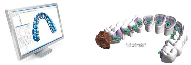 3Dデジタル・オーダーメイド設計イメージ1