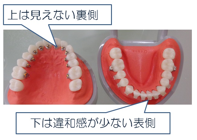 上は見えない裏側、下は違和感が少ない表側