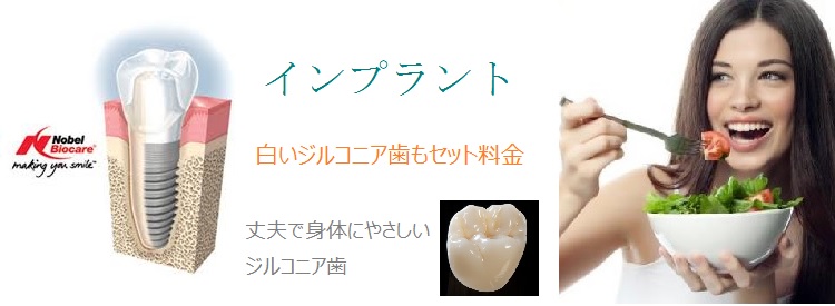 インプラント
